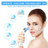 Blackhead Remover Vacuum - Facial Pore Cleanser Electric Acne Comedone Extractor Kit