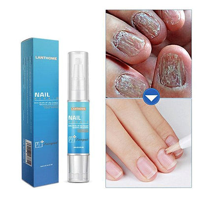 Nail Repair Treatment Liquid Fungus Remover Protective