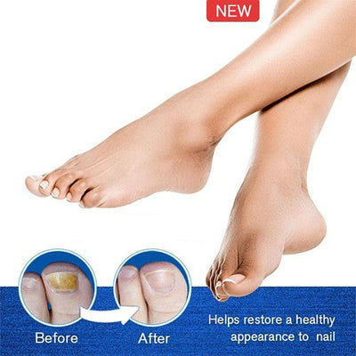 Nail Repair Treatment Liquid Fungus Remover Protective
