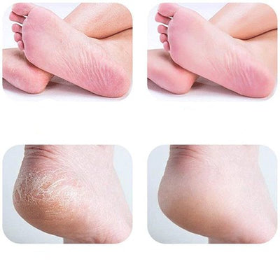 Foot Care Tool Hard Skin Remover Refills Replacement